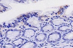 Immunohistochemistry (Paraffin-embedded Sections) (IHC (p)) image for anti-Fibroblast Growth Factor 10 (FGF10) antibody (ABIN7073940)