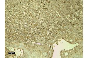 Immunohistochemistry (IHC) image for anti-Platelet/endothelial Cell Adhesion Molecule (PECAM1) (AA 218-231) antibody (ABIN7505819)