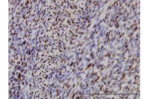 Image no. 1 for anti-Interferon Regulatory Factor 2 (IRF2) (AA 216-316) antibody (ABIN598766) (IRF2 antibody  (AA 216-316))