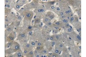 DAB staining on IHC-P; Samples: Human Liver Tissue (NPPC antibody  (AA 33-125))