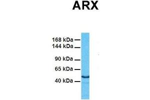 Host:  Rabbit  Target Name:  ARX  Sample Tissue:  Human Fetal Heart  Antibody Dilution:  1.