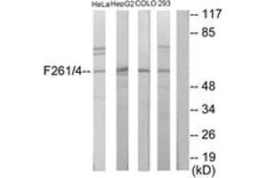 Western blot analysis of extracts from HeLa/HepG2/COLO205/293 cells, using PFKFB1/4 Antibody. (PFKFB1/4 antibody  (AA 331-380))
