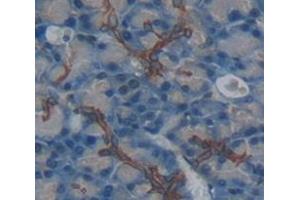 Used in DAB staining on fromalin fixed paraffin- embedded pancreas tissue (Nicastrin antibody  (AA 35-534))