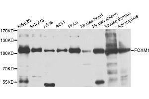 Western blot analysis of extracts of various cell lines, using FOXM1 antibody. (FOXM1 antibody)