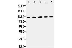 Observed bind size: 90KD (ICAM1 antibody  (AA 198-537))