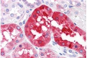 Human Kidney: Formalin-Fixed, Paraffin-Embedded (FFPE) (RNF144B antibody  (AA 1-101))