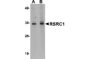 Western Blotting (WB) image for anti-arginine/serine-Rich Coiled-Coil 1 (RSRC1) (C-Term) antibody (ABIN1030630) (RSRC1 antibody  (C-Term))