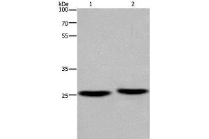 Western Blot analysis of Mouse brain and Human fetal muscle tissue using EPDR1 Polyclonal Antibody at dilution of 1:850