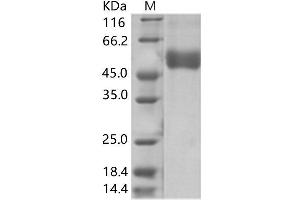 Western Blotting (WB) image for West Nile Virus NS1 (WNV NS1) protein (His tag) (ABIN7198746)