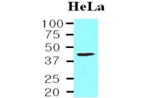 Cell lysates of HeLa(20 ug) were resolved by SDS-PAGE, transferred to nitrocellulose membrane and probed with anti-human TARDBP (1:1,000). (TARDBP antibody  (AA 1-260))