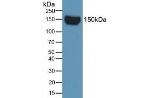 Western Blot; Sample: Rat Serum. (Complement Factor H antibody  (AA 975-1217))