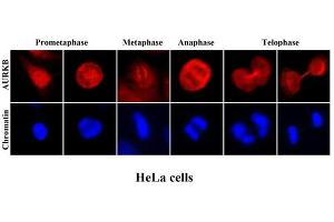 Immunofluorescenitrocellulosee of human HeLa cells stained with Hoechst 3342 (Blue) for chromatin staining and monoclonal anti-human Aurora kinase B antibody (1:2000) with Texas Red (Red). (Aurora Kinase B antibody  (AA 1-344))