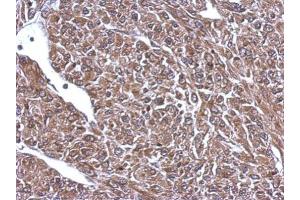 IHC-P Image Immunohistochemical analysis of paraffin-embedded U87 xenograft, using 68kDa Neurofilament Light, antibody at 1:500 dilution. (NEFL antibody)