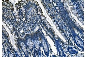 IHC analysis of PI-16/PI16 using anti-PI-16/PI16 antibody (ABIN7601074). (PI16 antibody  (AA 28-363))