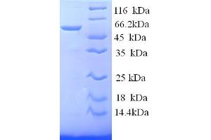 SDS-PAGE (SDS) image for S-Antigen, Retina and Pineal Gland (Arrestin) (SAG) (AA 1-405), (full length) protein (His tag) (ABIN5713812) (SAG Protein (AA 1-405, full length) (His tag))