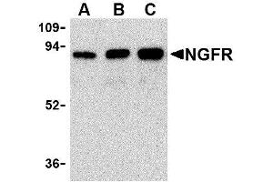 Western Blotting (WB) image for anti-Nerve Growth Factor Receptor (NGFR) antibody (ABIN2479591)