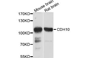 Western blot analysis of extracts of various cell lines, using CDH10 antibody (ABIN4903221) at 1:1000 dilution.