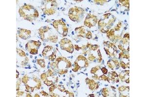 Immunohistochemistry of paraffin-embedded Human stomach using C1QC Polyclonal Antibody at dilution of 1:100 (40x lens). (C1QC antibody)