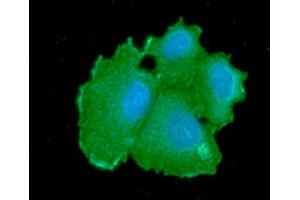 ICC/IF analysis of CBR1 in Hep3B cells line, stained with DAPI (Blue) for nucleus staining and monoclonal anti-CBR1 antibody (1:100) with goat anti-mouse IgG-Alexa fluor 488 conjugate (Green). (CBR1 antibody  (AA 1-277))