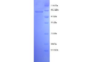 Malate Dehydrogenase 1, NAD (Soluble) (MDH1) (AA 2-333), (full length) protein (GST tag) (MDH1 Protein (AA 2-333, full length) (GST tag))