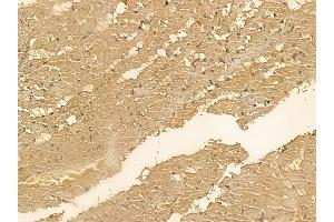 SMAP2 Mouse Monoclonal Antibody at 1/100 staining rat heart tissue by IHC-P.