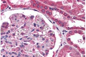 Human Kidney (formalin-fixed, paraffin-embedded) stained with COL18A1 antibody ABIN307188 at 1:100 followed by biotinylated anti-mouse IgG secondary antibody ABIN481714, alkaline phosphatase-streptavidin and chromogen. (COL18A1 antibody)