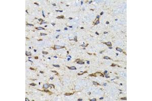 Immunohistochemistry of paraffin-embedded mouse spinal cord using CDK1 antibody (ABIN5970051) at dilution of 1/100 (40x lens). (CDK1 antibody  (Center))