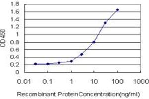 Detection limit for recombinant GST tagged DBF4 is approximately 0. (DBF4 antibody  (AA 2-98))