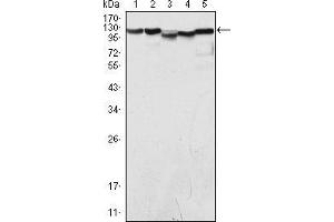 Western blot analysis using LSD1 mouse mAb against COS (1), Hela (2), NIH/3T3 (3), A549 (4) and Jurkat (5) cell lysate. (LSD1 antibody)