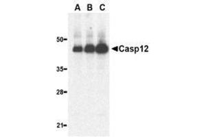 Western blot analysis of caspase-12 in human heart lysate with AP30192PU-N caspase-12 antibody (large) at 0. (Caspase 12 antibody  (large))