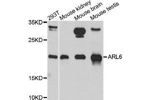 Western blot analysis of extracts of various cell lines, using ARL6 antibody. (ARL6 antibody  (AA 1-186))