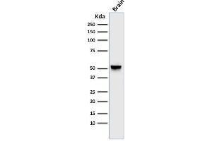 Western Blot Analysis of human brain tissue lysate using GFAP Mouse Monoclonal Antibody (GA-5). (GFAP antibody)