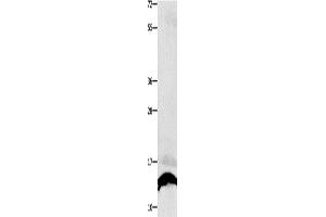 Western Blotting (WB) image for anti-Cytochrome C Oxidase Subunit Vb (COX5B) antibody (ABIN2421039) (COX5B antibody)