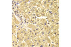 Immunohistochemistry of paraffin-embedded Human liver injury using TRAF3IP2 antibody at dilution of 1:100 (x400 lens). (TRAF3IP2 antibody)