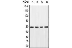 Western blot analysis of GPR75 expression in HEK293T (A), A549 (B), SP2/0 (C), rat kidney (D) whole cell lysates.