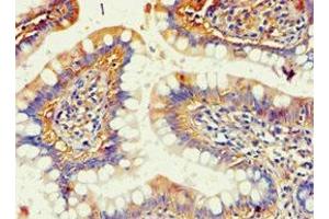 Immunohistochemistry of paraffin-embedded human small intestine tissue using ABIN7143685 at dilution of 1:100 (AKR1B1 antibody  (AA 1-316))