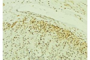 ABIN6277054 at 1/100 staining Human gastric tissue by IHC-P. (IKK alpha antibody  (N-Term))