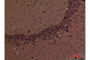 Immunohistochemistry (IHC) analysis of paraffin-embedded Mouse Brain, antibody was diluted at 1:100. (INPPL1 antibody  (Internal Region))