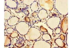Immunohistochemistry of paraffin-embedded human thyroid tissue using ABIN7146159 at dilution of 1:100 (C2CD3 antibody  (AA 2079-2265))