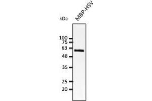 Western Blotting (WB) image for anti-HSV Tag antibody (ABIN7272989) (HSV Tag antibody)