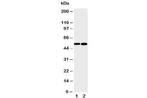 Western blot testing of NFKB2 antibody and Lane 1: mouse liver