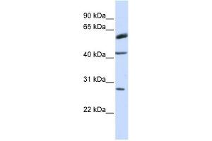 RNF170 antibody used at 1 ug/ml to detect target protein. (RNF170 antibody  (Middle Region))