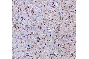 IHC analysis of RTF1 using anti-RTF1 antibody (ABIN7602444). (RTF1 antibody  (AA 77-705))
