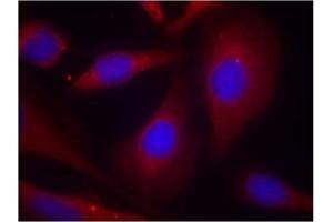 Image no. 2 for anti-Nuclear Factor of kappa Light Polypeptide Gene Enhancer in B-Cells 1 (NFKB1) (Ser927) antibody (ABIN319347) (NFKB1 antibody  (Ser927))