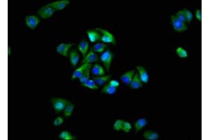 Immunofluorescence staining of Hela cells with ABIN7153969 at 1:100, counter-stained with DAPI. (GRIK1 antibody  (AA 675-834))