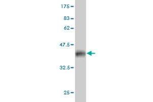 Western Blot detection against Immunogen (36. (PFN2 antibody  (AA 41-140))