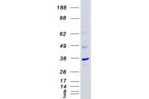 Validation with Western Blot (CDK4 Protein (Myc-DYKDDDDK Tag))