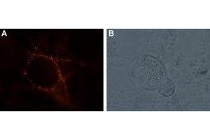 Expression of kainate receptor GluK1 in rat DRG neurons - Cell surface detection of kainate receptor GluK1 in living rat dorsal root ganglion (DRG).