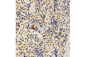 Immunohistochemistry of paraffin embedded mouse spleen using CCRL2 (ABIN7073461) at dilution of 1:300 (400x lens)