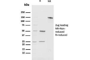 SDS-PAGE (SDS) image for anti-BMI1 Polycomb Ring Finger Oncogene (BMI1) (AA 142-326) antibody (ABIN6940580)